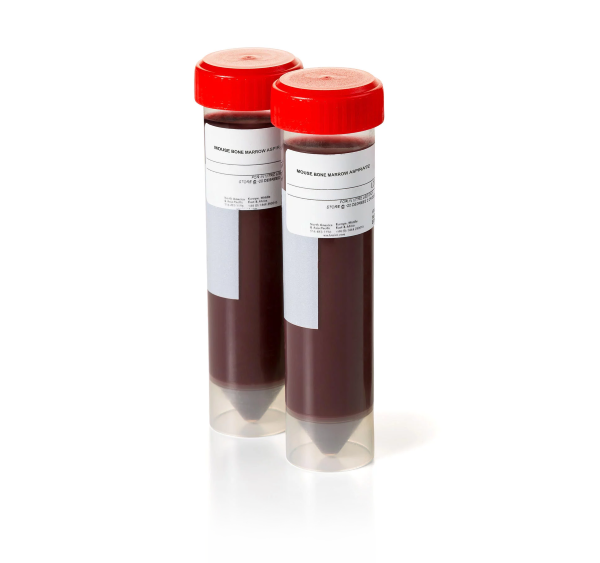 Bone-Marrow-2