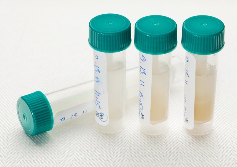 other biological samples