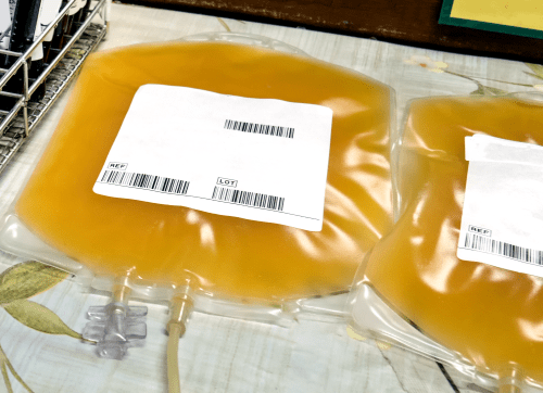 Plasmapheresis