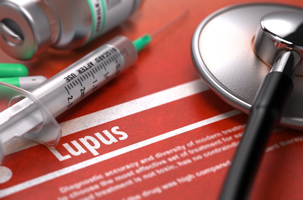 Lupus